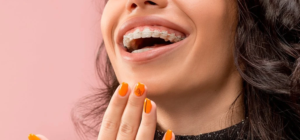 Le traitement appareils dentaires céramiques